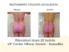 risultato-bobadilla-cellulite-1-giugno-2013