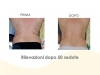 diapositiva49