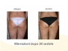 diapositiva93